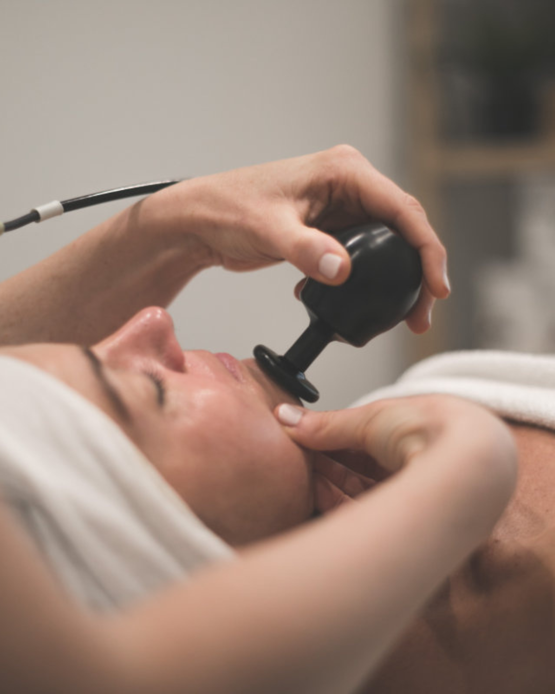 Lifting facial: Winback + Ácido Hialurónico
