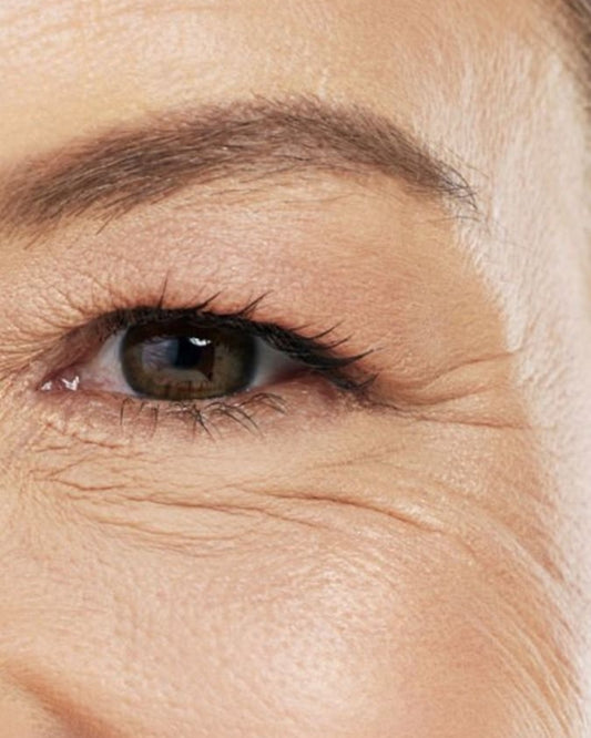 Zona periocular y edema malar